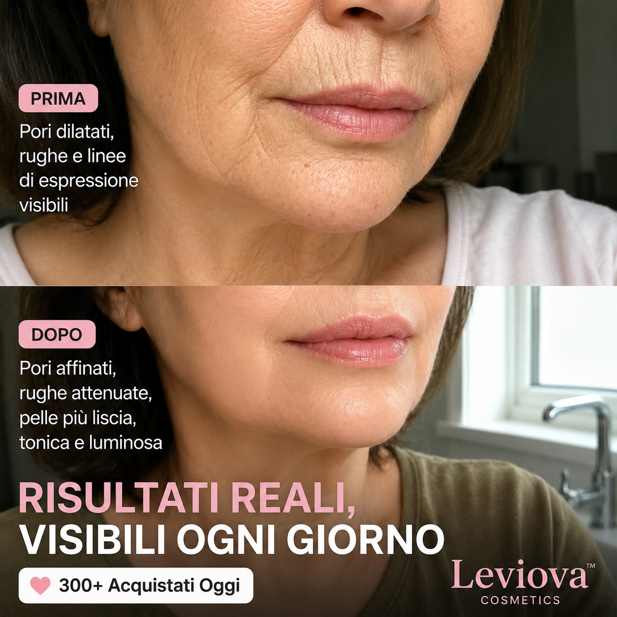 LEVIOVA™- Stick Rimpolpante al Biocollagene PDRN