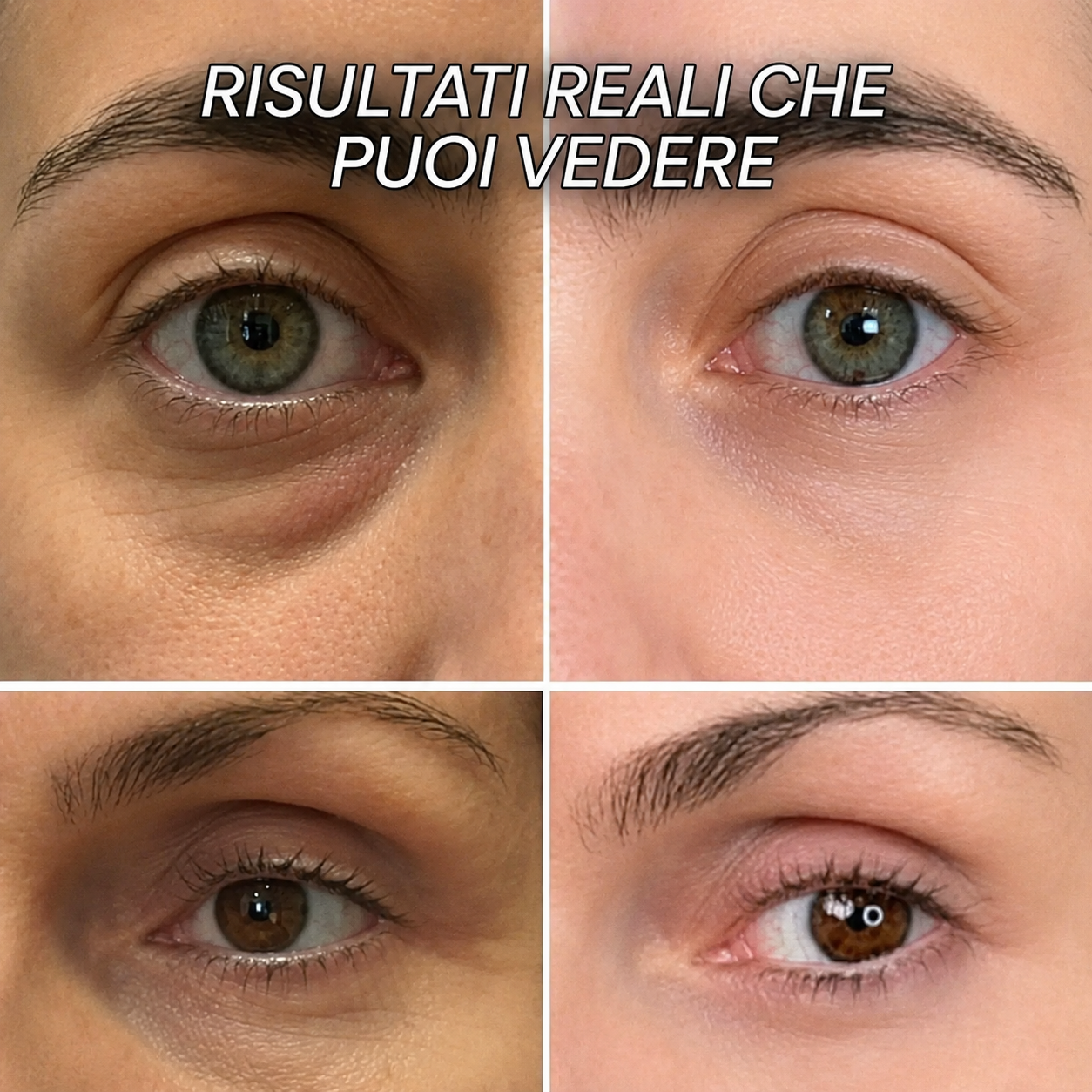 LEVIOVA™- Stick Rimpolpante al Biocollagene PDRN