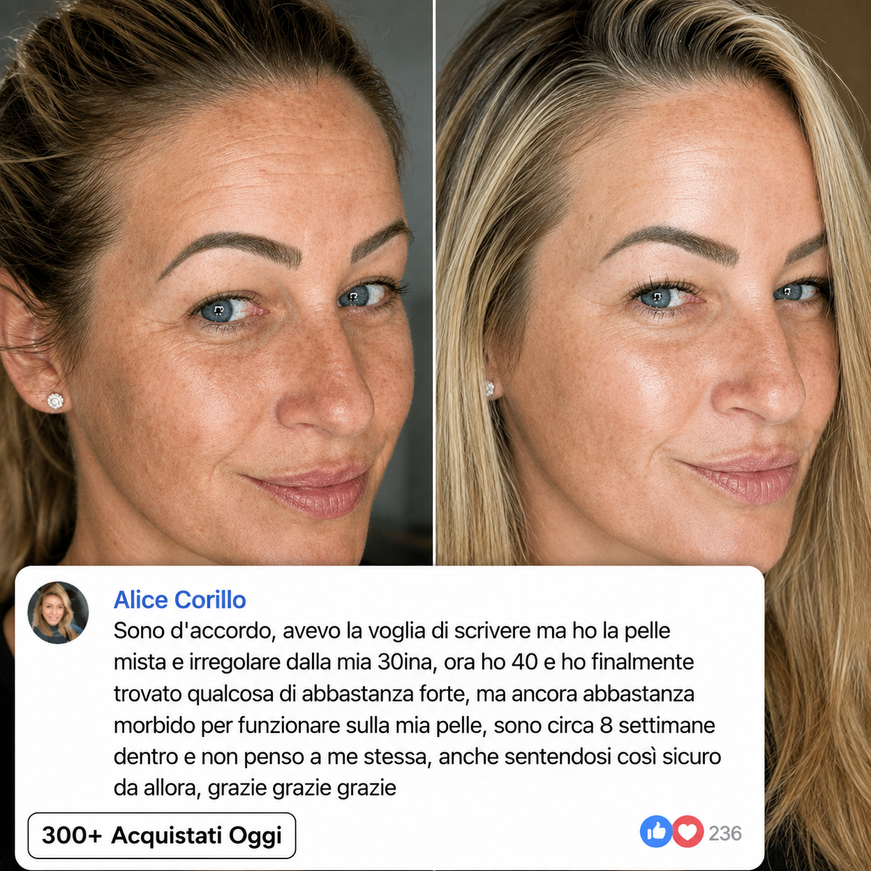 LEVIOVA™- Stick Rimpolpante al Biocollagene PDRN