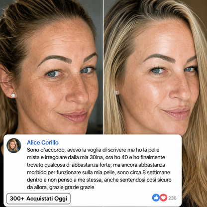 LEVIOVA™- Stick Rimpolpante al Biocollagene PDRN