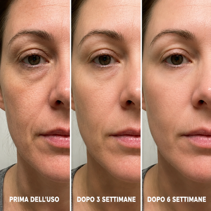 LEVIOVA™- Stick Rimpolpante al Biocollagene PDRN