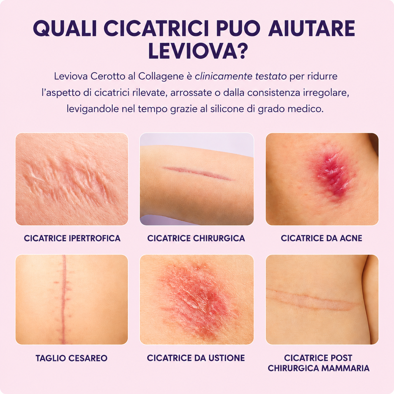 LEVIOVA™ - Fogli di collagene-siliconico